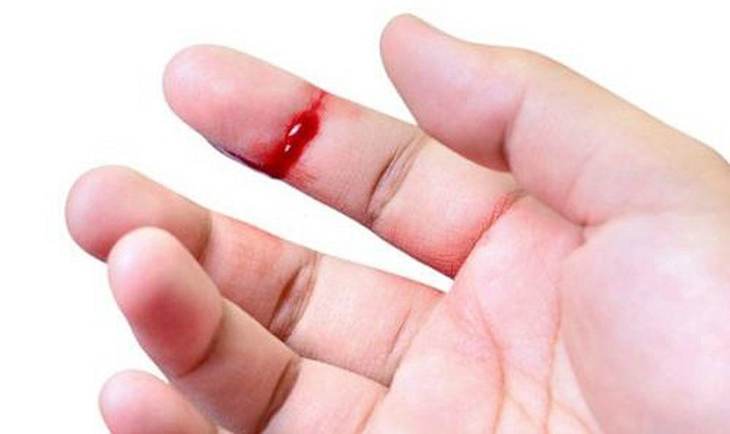 Đứt tay chảy máu đánh con gì