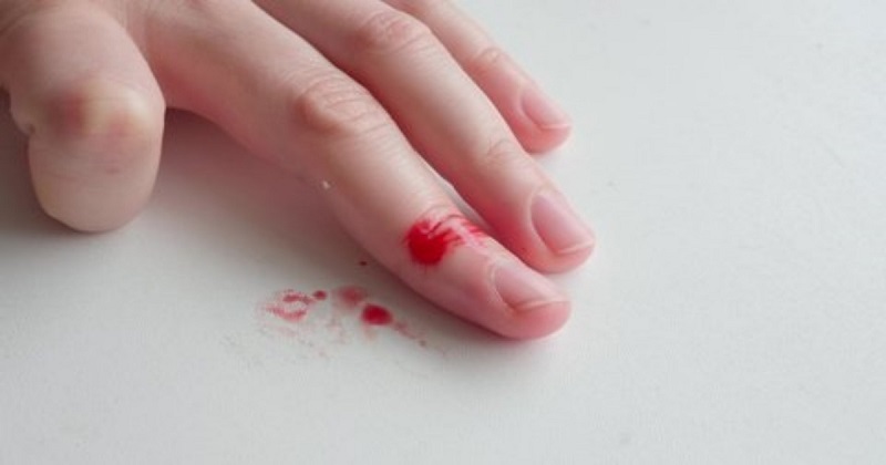 Đứt tay chảy máu đánh con gì