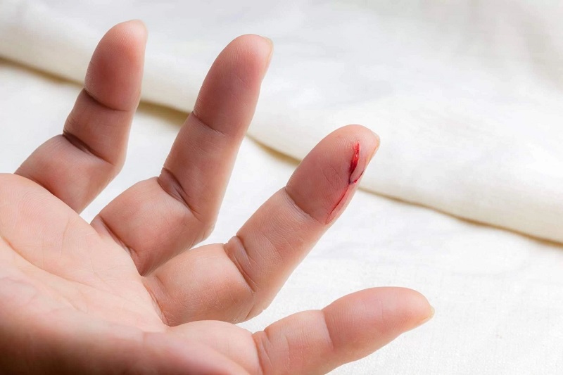Đứt tay chảy máu đánh con gì